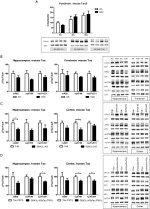 Phospho-Tau (Ser199) Antibody in Western Blot (WB)