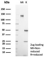 Interleukin-1 beta (IL-1 beta) Antibody in SDS-PAGE (SDS-PAGE)