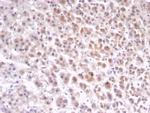 IL1RN/IL-1RN/IL1RA (Interleukin-1RA) Monoclonal Antibody (IL1RA/4716)