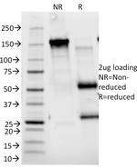 CD25/IL2RA (Activated Lymphocyte Marker) Antibody in SDS-PAGE (SDS-PAGE)