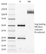 CD25/IL2RA (Activated Lymphocyte Marker) Antibody in SDS-PAGE (SDS-PAGE)