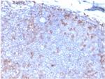 Fas Ligand (FASLG) Monoclonal Antibody (FASLG/4453)