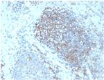 Fas Ligand (FASLG) Monoclonal Antibody (FASLG/4456)