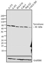 Tyrosinase Antibody in Western Blot (WB)