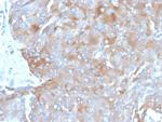 Interleukin-3 (IL-3) Monoclonal Antibody (IL3/4003)