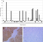 NY-ESO-1 Antibody in Immunohistochemistry (IHC)