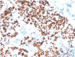 IL3RA/CD123 Monoclonal Antibody (IL3RA, 1531)