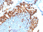 IL3RA/CD123 (Acute Myeloid Leukemia Marker) Antibody in Immunohistochemistry (Paraffin) (IHC (P))