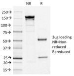IL3RA/CD123 (Acute Myeloid Leukemia Marker) Antibody in SDS-PAGE (SDS-PAGE)