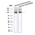 IL3RA/CD123 (Acute Myeloid Leukemia Marker) Antibody in Western Blot (WB)