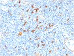 IL3RA/CD123 (Acute Myeloid Leukemia Marker) Antibody in Immunohistochemistry (Paraffin) (IHC (P))