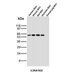 IL3RA/CD123 (Acute Myeloid Leukemia Marker) Antibody in Western Blot (WB)