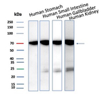 IL3RA/CD123 (Acute Myeloid Leukemia Marker) Antibody in Western Blot (WB)