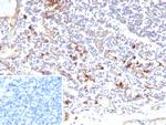 IL3RA/CD123 (Acute Myeloid Leukemia Marker) Recombinant Mouse Monoclonal Antibody (rIL3RA/9212)