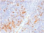 IL3RA/CD123 Antibody in Immunohistochemistry (Paraffin) (IHC (P))