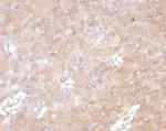 IL-6 (Interleukin-6)/Interferon beta-2 (Hybridoma Growth Factor) Monoclonal Antibody (IL6/4641)