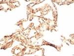 IL-6 (Interleukin-6)/Interferon beta-2 (Hybridoma Growth Factor) Monoclonal Antibody (IL6/4643)