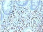 IL6ST/CD130/Interleukin 6 Signal Transducer/IL6RB Monoclonal Antibody (IL6ST/4101)