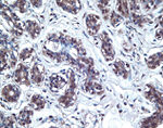 VEGF Receptor 3 Antibody in Immunohistochemistry (IHC)