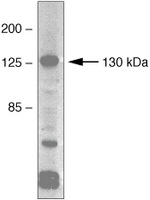 VEGF Receptor 1 (soluble) Polyclonal Antibody