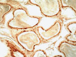 MIF Antibody in Immunohistochemistry (IHC)