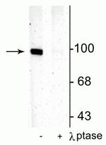 Phospho-GluR1 (Ser831) Polyclonal Antibody