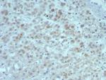Interleukin-15 (IL-15) Recombinant Mouse Monoclonal Antibody (rIL15/8049)