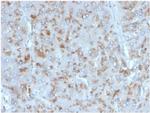 Interleukin-15 (IL-15) Monoclonal Antibody (IL15/4354)