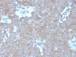 Interleukin-15 (IL-15) Monoclonal Antibody (IL15/4355)