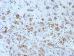 Interleukin-15 (IL-15) Monoclonal Antibody (IL15/4696)