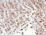 Interleukin-15 (IL-15) Monoclonal Antibody (IL15/4699)