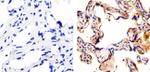 VEGF Receptor 3 Antibody in Immunohistochemistry (Paraffin) (IHC (P))