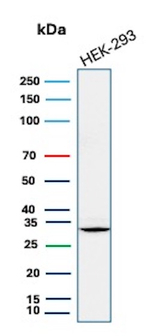 CD137/4-1BB/TNFRSF9 (Marker of Activated T Cells & NK Cells) Antibody in Western Blot (WB)