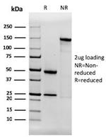 Aquaporin 4 (AQP4) Antibody in SDS-PAGE (SDS-PAGE)