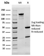 Aquaporin 4 (AQP4) Antibody in SDS-PAGE (SDS-PAGE)