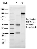 Aquaporin 4 (AQP4) Antibody in SDS-PAGE (SDS-PAGE)