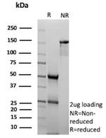 Inhibin, alpha (INHA) (Gonadal Cell Marker) Antibody in SDS-PAGE (SDS-PAGE)