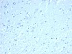 Inhibin, alpha (INHA) (Gonadal Cell Marker) Recombinant Rabbit Monoclonal Antibody (INHA/8872R)