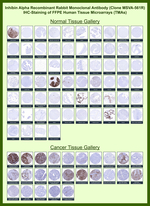 Inhibin, alpha (INHA) (Gonadal Cell Marker) Antibody in Immunohistochemistry (Paraffin) (IHC (P))