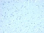 Inhibin, alpha (INHA) Antibody in Immunohistochemistry (Paraffin) (IHC (P))