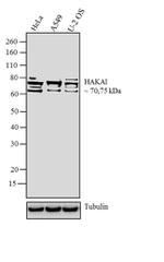 CBLL1 Antibody in Western Blot (WB)