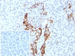 Insulin/IRDN (beta-Cell and Insulinoma Marker) Monoclonal Antibody (rIRDN/8546)
