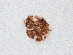 Insulin/IRDN Recombinant Mouse Monoclonal Antibody (rIRDN, 805)