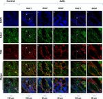 Syndecan 4 Antibody in Immunohistochemistry (IHC)