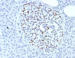 INSM1 (Pan-Neuroendocrine Marker) Antibody in Immunohistochemistry (Paraffin) (IHC (P))