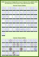 INSM1 (Pan-Neuroendocrine Marker) Recombinant Rabbit Monoclonal Antibody (MSVA-456R)