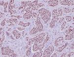 INSM1 (Pan-Neuroendocrine Marker) Recombinant Rabbit Monoclonal Antibody (INSM1/6286R)