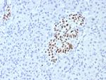 INSM1 (Pan-Neuroendocrine Marker) Recombinant Rabbit Monoclonal Antibody (INSM1/7992R)