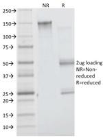 Insulin Receptor Alpha Monoclonal Antibody (INSR/1661)