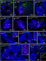 Connexin 36 Antibody in Immunohistochemistry (IHC)